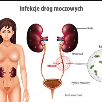 Hormonális rendellenességek kezelése